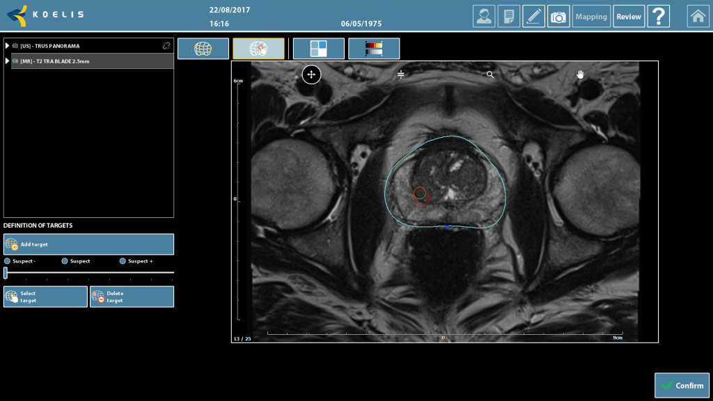 1210 rezonans mri cotour target 2 1