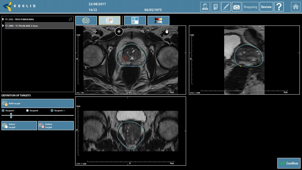 1249 rezonans mri cotour target 1